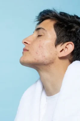 side view man with skin problems